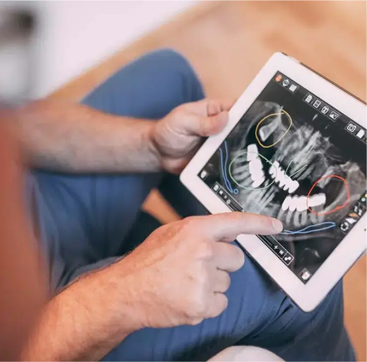 Digitale Röntgenanalyse bei einer endodontischen Behandlung in der Zahnarztpraxis Sandhofpassage Bad Soden – präzise Diagnostik für Wurzelkanalbehandlung