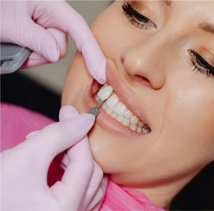 Zahnarzt in Bad Soden passt die Zahnfarbe für eine ästhetische Zahnbehandlung an, um ein harmonisches und natürliches Lächeln zu erzielen.