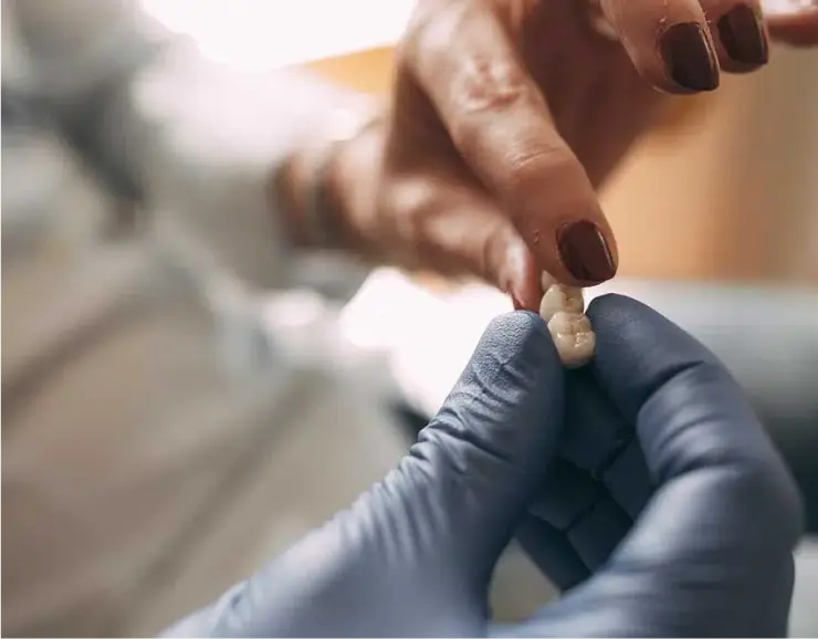 Nahaufnahme eines Zahnersatzes in der Zahnarztpraxis Sandhofpassage Bad Soden. Eine Zahnbrücke wird von einer Zahnarzthelferin und einer Patientin begutachtet.